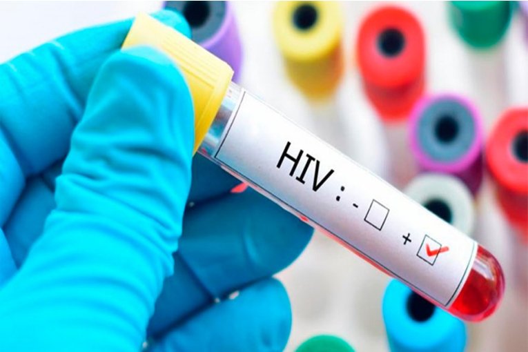 VIH: El 98% de las nuevas infecciones son por relaciones sexuales sin protección