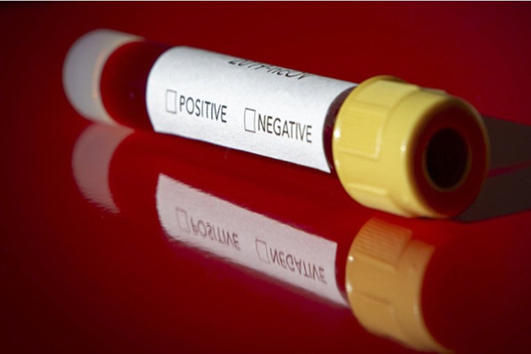 Este jueves se registraron cuatro casos de coronavirus en una sola ciudad de Entre Ríos
