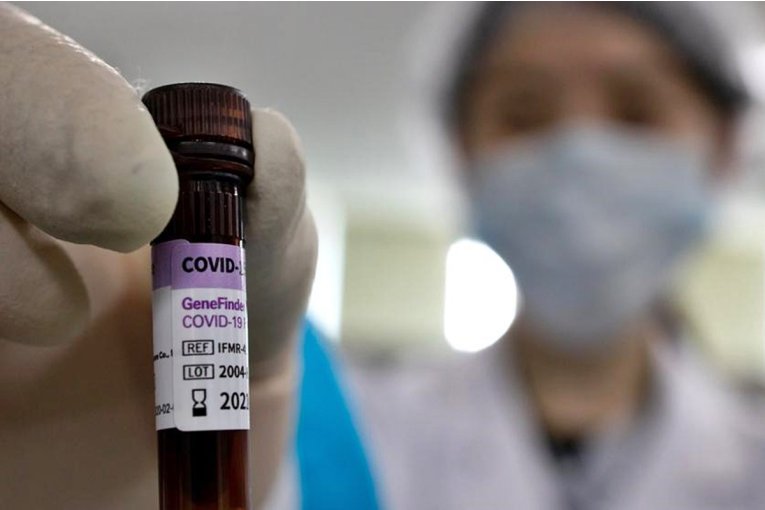 Concordia suma este jueves tres casos positivos de COVID 19