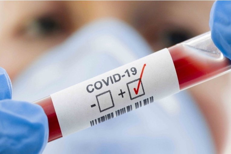 Entre Ríos sumó más 1880 casos de Coronavirus en las últimas 48 horas