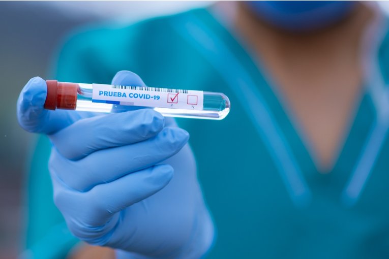 Entre Ríos sumó más 1350 casos de Coronavirus en las últimas 48 horas