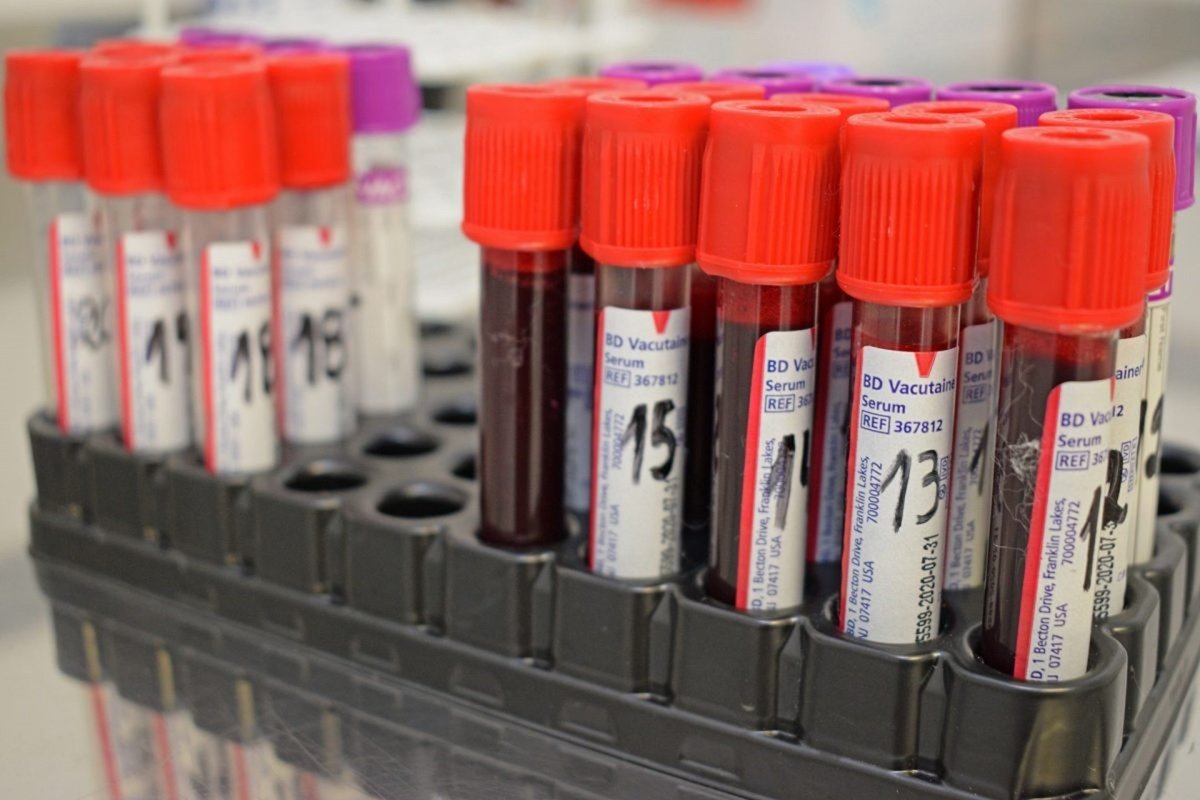 Más de 1.400 entrerrianos donaron sangre en 2024. Más de 1.400 entrerrianos donaron sangre en 2024.