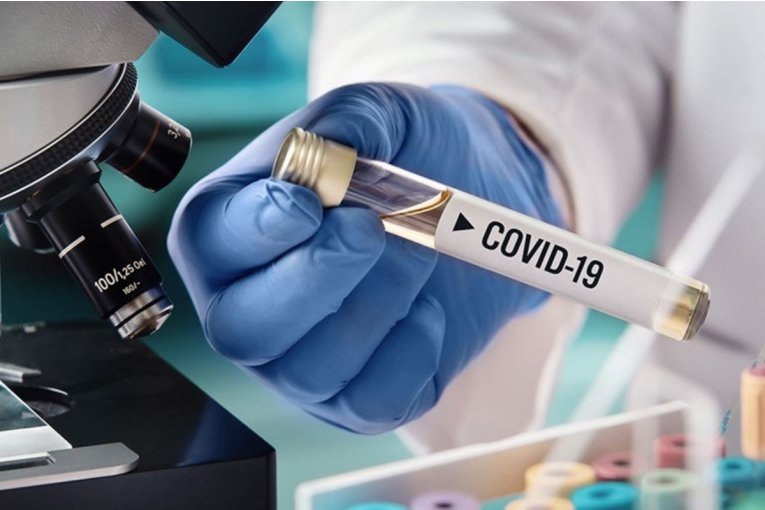 Nación confirmó que Entre Ríos sumó más de 1900 nuevos casos de Covid en 24 horas